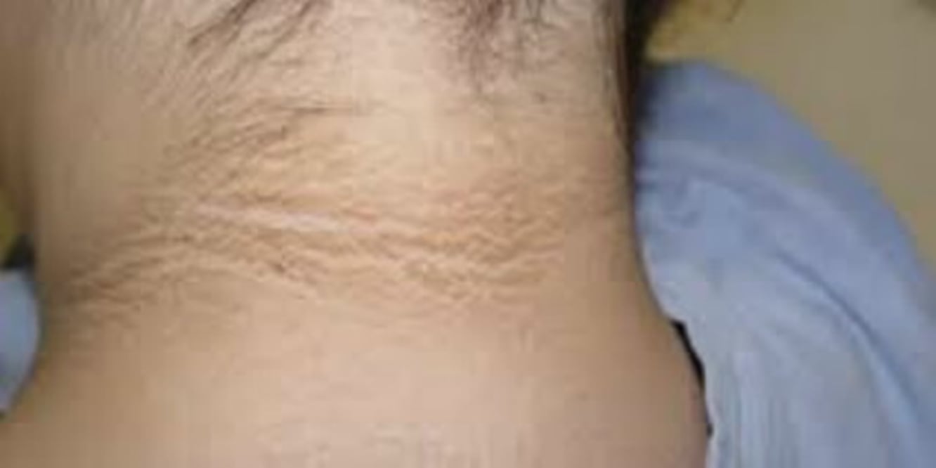 ¿Tienes manchas oscuras en la piel?