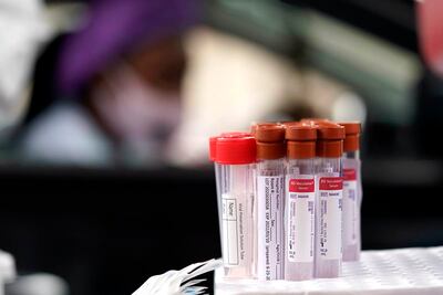 Coronavirus: OMS pide 31.300 mdd para vacunas y tratamientos contra COVID