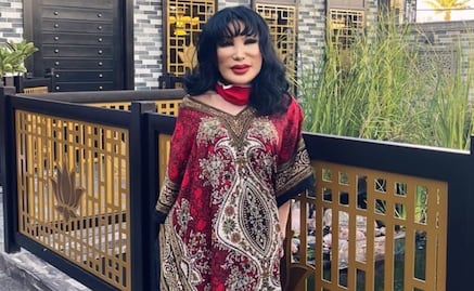 Comparan "nuevo rostro" de Lyn May con el de famosos como Saw y Ninel Conde