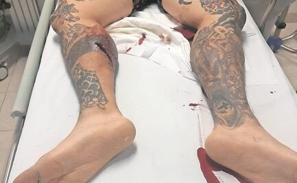 Sujeto balea a comerciante por “ver a su novia”