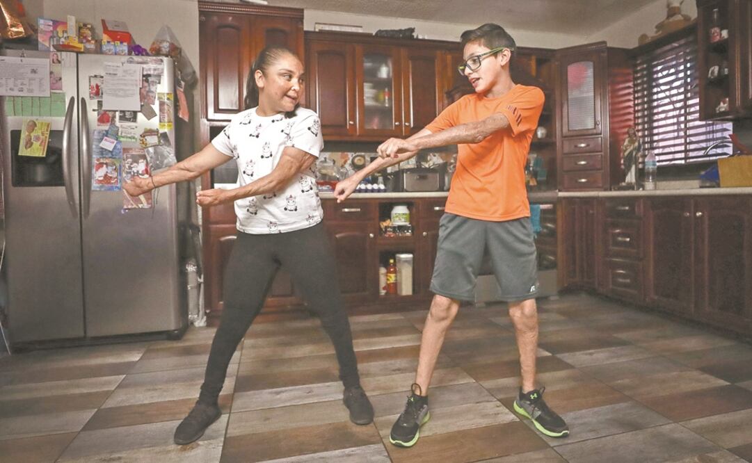 A 10 años del incendio de la estancia infantil, Danna Paola y César Fernando, dos adolescentes sobrevivientes, llevan a cabo su día a día con normalidad. Aseguran que ya aceptaron las secuelas físicas que les dejó el fuego. Foto: DIEGO SIMÓN SÁNCHEZ