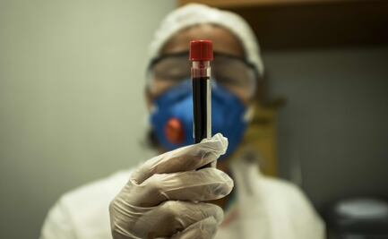 Anticuerpos del Covid-19 duran, al menos, tres meses: estudio en sangre y saliva