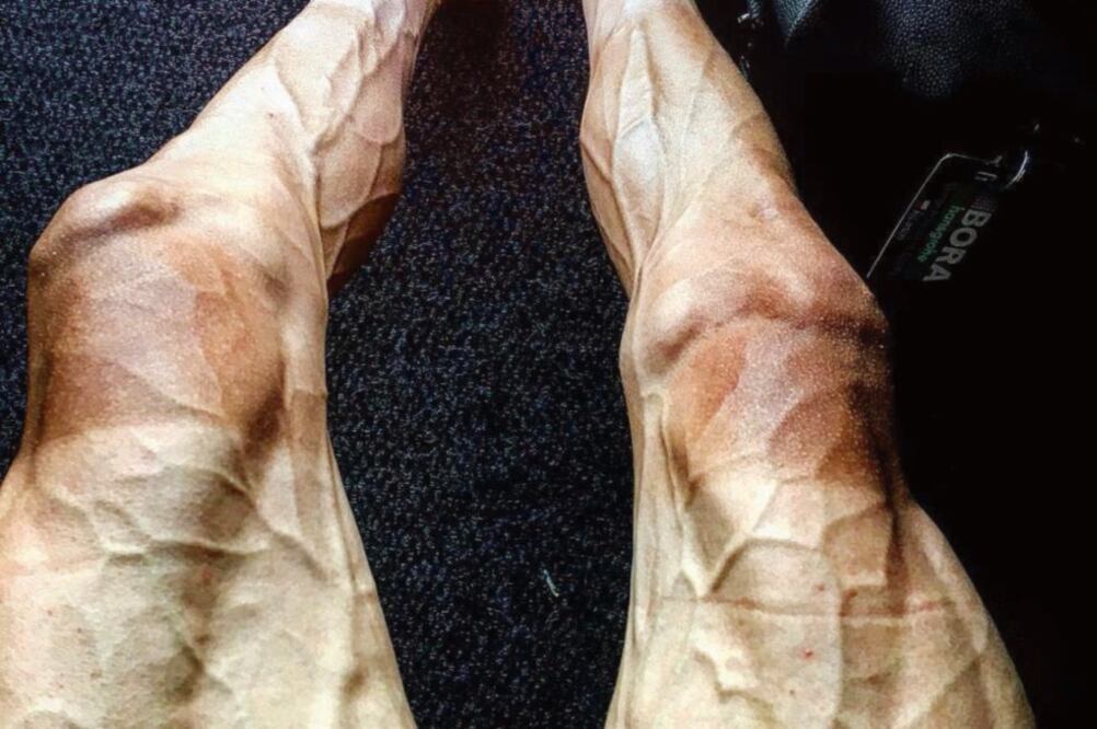 Poljanski sufrió estragos en sus piernas durante el Tour de Francia (ARCHIVO. EL UNIVERSAL)