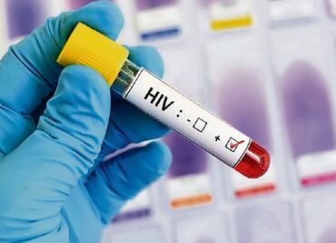 "Controladores del VIH": Identifican pacientes con baja carga viral que no usan tratamiento