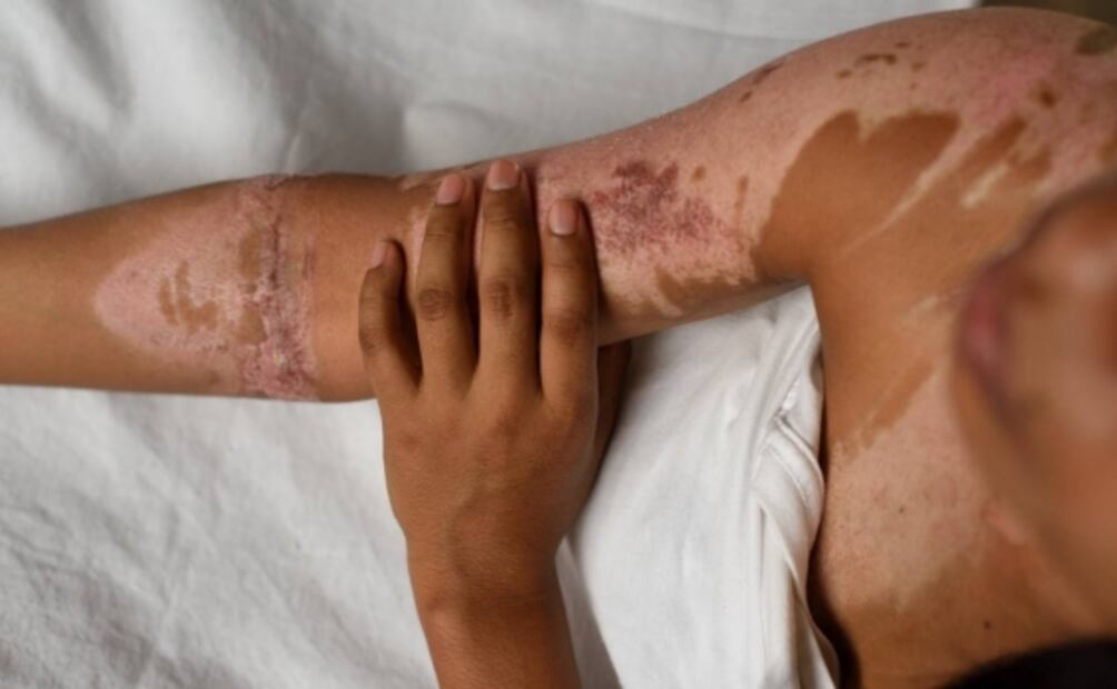 Fotógrafo de EL UNIVERSAL es reconocido con Premio Alemán de Periodismo Walter Reuter