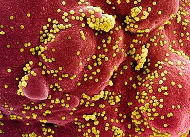 Científicos mexicanos descubren células agravantes de la covid-19