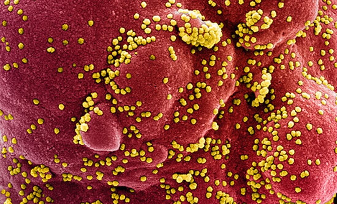 Foto: EFE/EPA/NIAID/NATIONAL INSTITUTES OF HEALTH HANDOUT