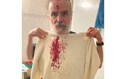 Pasajeros golpean y asaltan a conductor de Uber en Naucalpan; denuncian que la empresa no lo apoyó