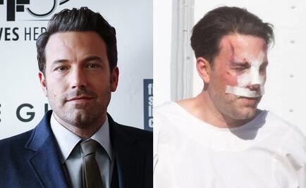 Ben Affleck ¿transforma su rostro con cirugía?
