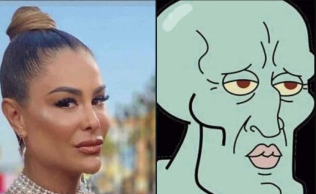 ¿Qué le pasa al rostro de Ninel Conde?, los filtros no la favorecen