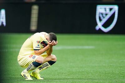 El fracaso evidencia carencias en el América