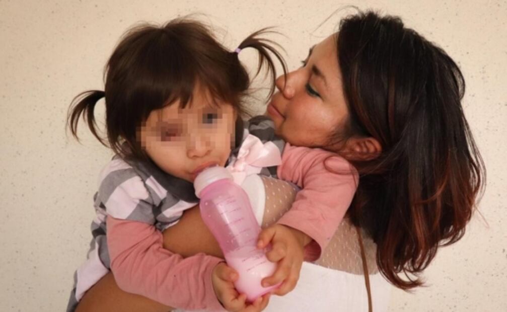 Piden apoyo para Ximena, la niña de dos años que padece cáncer ocular en Neza