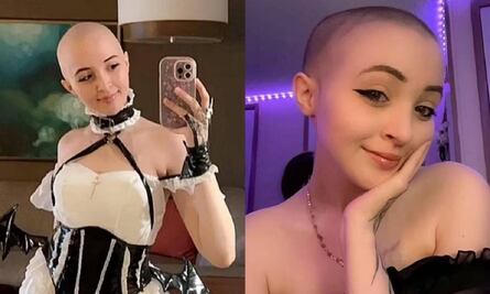 Le diagnostican cáncer y abre cuenta en OnlyFans para pagar su tratamiento