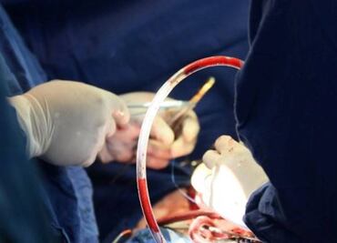 Realizan con éxito el treceavo trasplante de corazón en el Hospital General de La Raza