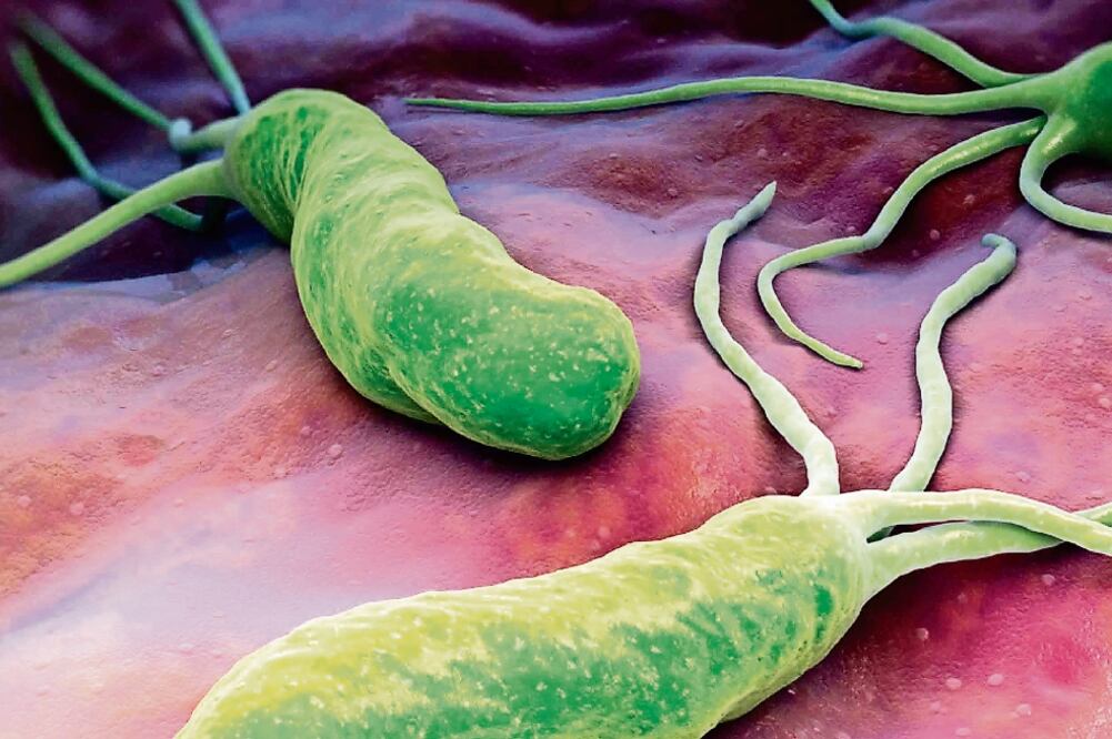 Esta bacteria está reconocida como un carcinógeno categoría I en humanos (ESPECIAL)
