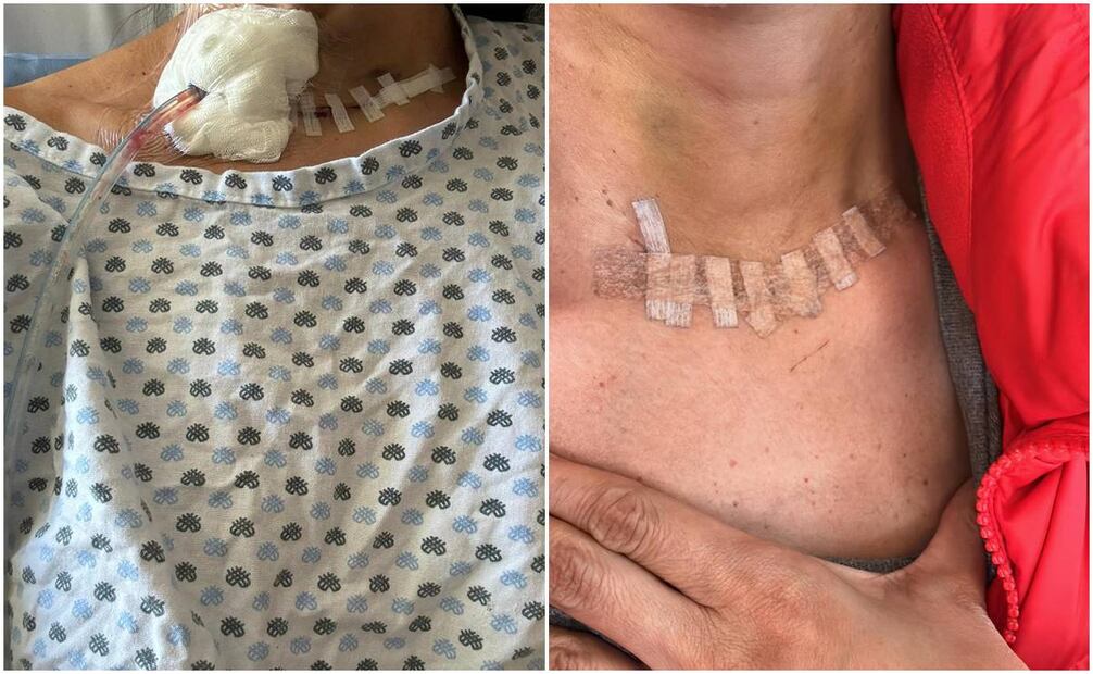 Cynthia Urias mostró fotos de su recuperación.