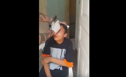 Recaudan dinero para borrar tatuaje a joven que intentó robar una bicicleta