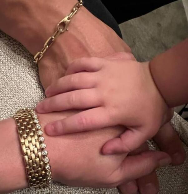 ¿Parálisis facial? Fans de Katy Perry preocupados desatan teorías sobre lo que le pasó a su ojo