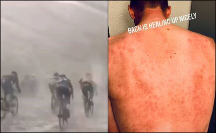 Ciclista muestra como queda su espalda tras rodar en granizada