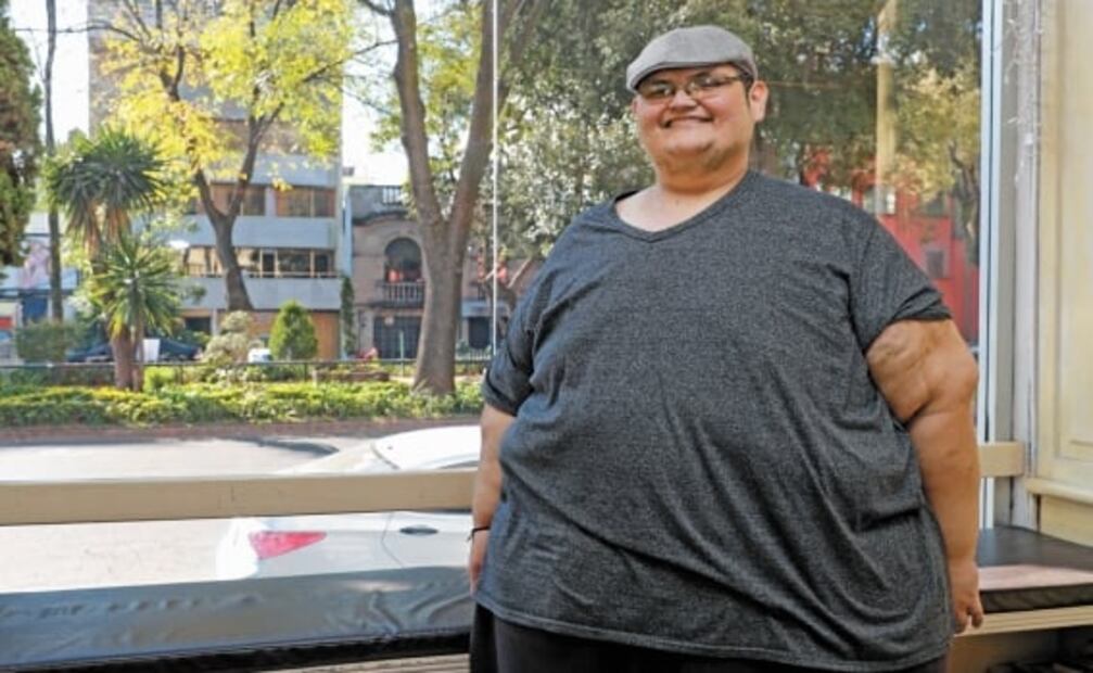 Sobrevivir al Covid-19 con más de 200 kilos de peso, la historia de Juan Pedro, el hombre más obeso del mundo