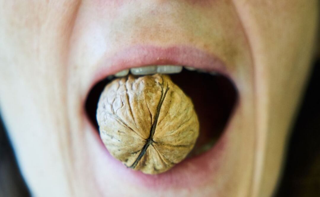 Alimentos y colesterol. Foto: Pixabay