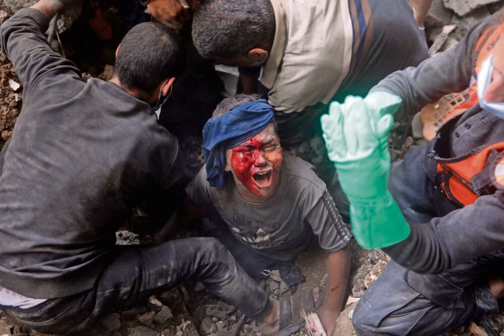 Un niño palestino, mientras los rescatistas intentan sacarlo de escombros, en el campo de refugiados de Bureij, Franja de Gaza. Foto: AP