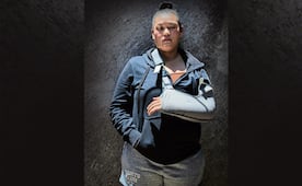 Alejandra Suárez recibió 9 disparos y no se investiga como intento de feminicidio; “no me mató, pero me quitó la tranquilidad”