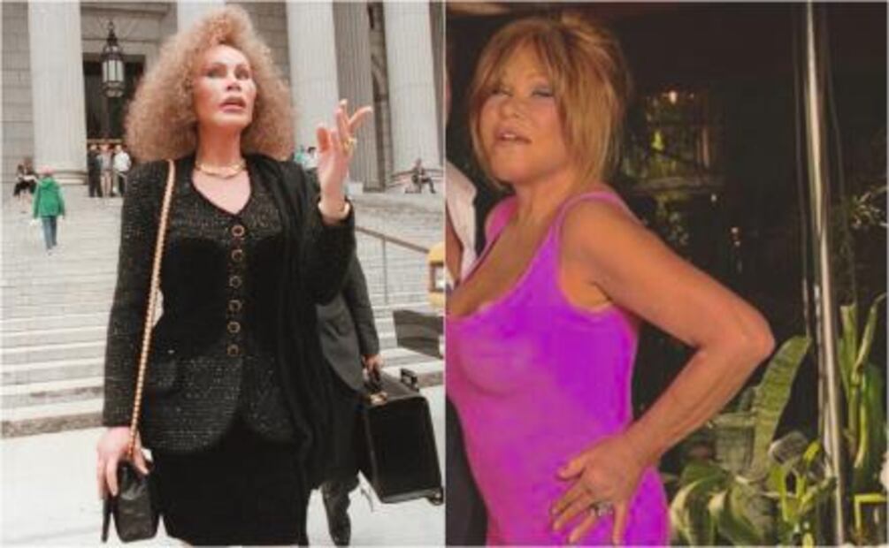 Personalidades de la moda que se pasaron de cirugías