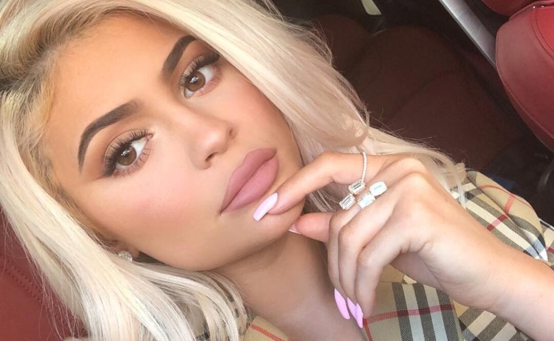 Kylie Jenner se inyectó los labios para obtener una apariencia voluminosa. Foto: Instagram kyliejenner