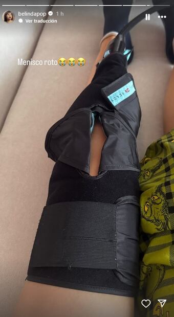 Belinda comparte foto y confiesa que tiene un menisco roto, es decir, un desgarro del fibrocartílago de la rodilla, que actúa como amortiguador y ayuda a distribuir el peso.