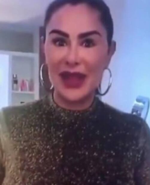 ¿Qué le pasa al rostro de Ninel Conde?, los filtros no la favorecen