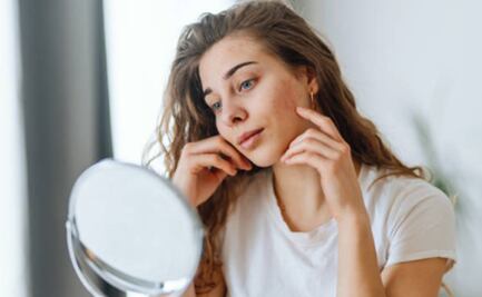 Contingencia Ambiental: Estos son los daños que provoca el ozono en la piel 