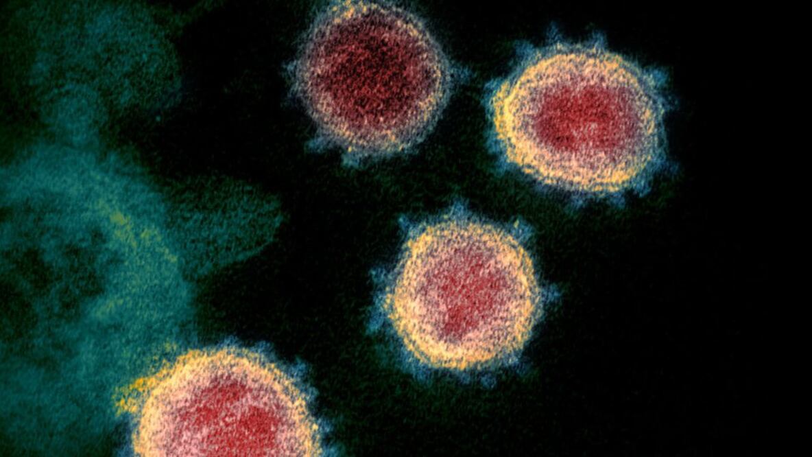 Los científicos no descartan que el misterioso gen hallado contribuya a la biología única del virus. Foto: Getty Images vía BBC