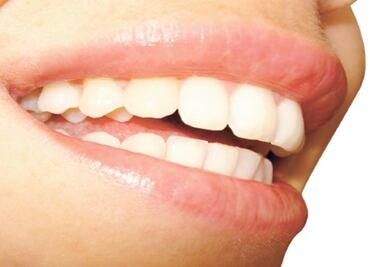 Diputados locales, preocupados por higiene bucal