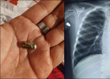 Balacera se desata en celebración de Año Nuevo en Nogales, Sonora; bala perdida alcanza a niño de 8 años