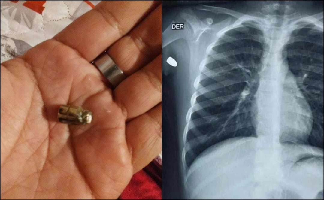 El menor se encontraba con su familia en el porche de su domicilio, cuando fue alcanzado por un proyectil de arma de fuego. Foto: Especial