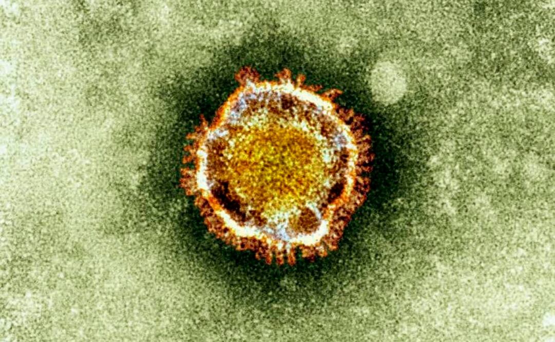 Foto: AP Photo/Health Protection Agency, archivo