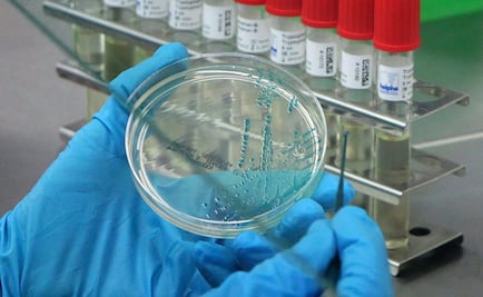 Descartan riesgos por brote de cólera en Hidalgo