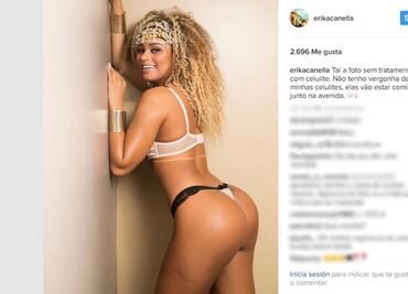 Miss Bumbum muestra su celulitis y estrías