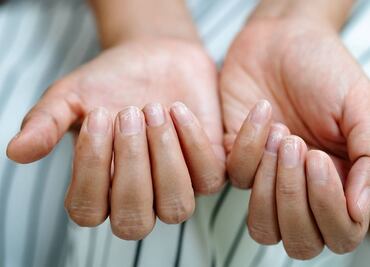 Cómo quitar las estrías en las uñas