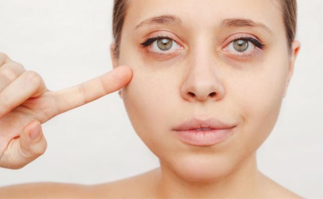 El yoga va más allá de una simple actividad física, es una filosofía de vida. Fuente: Freepik.