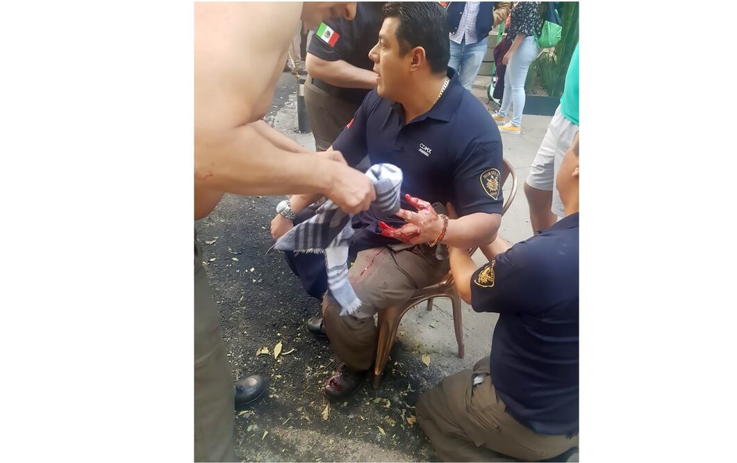 Ismael Figueroa sufrió dos impactos de bala; para revisar la herida en el abdomen tuvo que ser sometido a una laparoscopía. (FOTO: ESPECIAL)