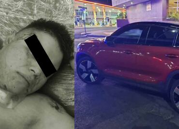 Presunto ladrón resulta herido tras enfrentamiento con policías en Tlalnepantla