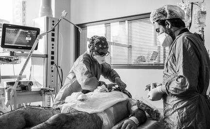 Los hombres tienen tres veces más probabilidades de Covid-19 grave