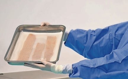 Donan tejidos para víctimas de la explosión en Puente la Concordia