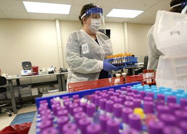 Laboratorio anuncia que medicamento funciona contra Covid-19; estudio lo contradice