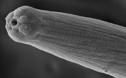 Veneno de un parásito evade el sistema inmune del ser humano