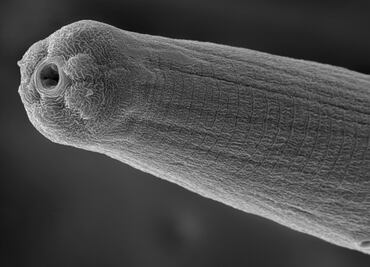 Veneno de un parásito evade el sistema inmune del ser humano