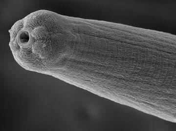 Veneno de un parásito evade el sistema inmune del ser humano