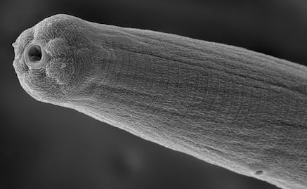 Veneno de un parásito evade el sistema inmune del ser humano